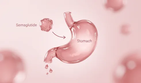 Stylized illustration of a rounded stomach with three small droplets below its lower end, tagged Stomach, with a knobbly round molecule labelled Semaglutide arriving along a curved arrow.